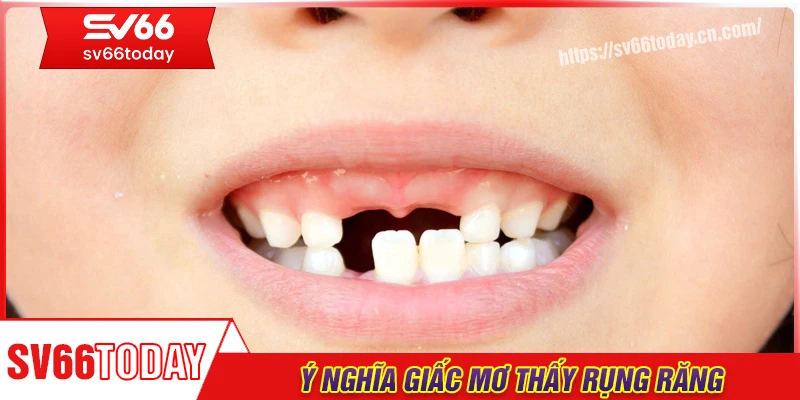 Ý nghĩa về giấc mơ thấy rụng răng